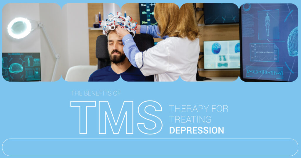 TMS Therapy for Treating Depression